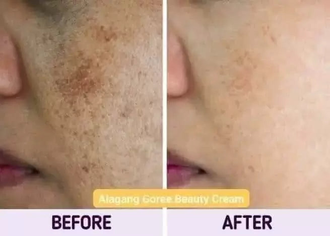 GOREE Day & Night Whitening Cream