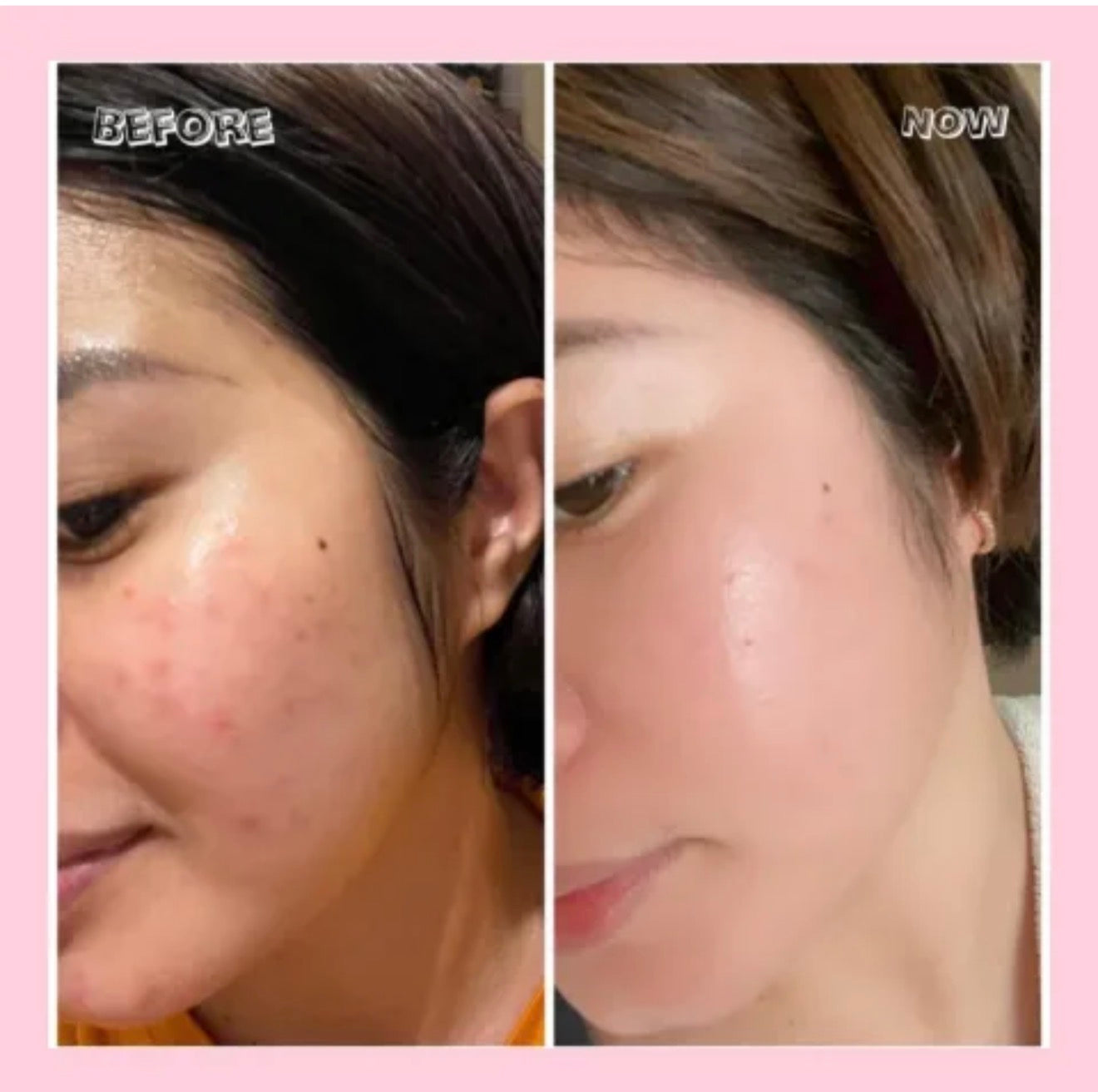 Her Choice Ph NaturaZen FujiGlow+ Glutathione
