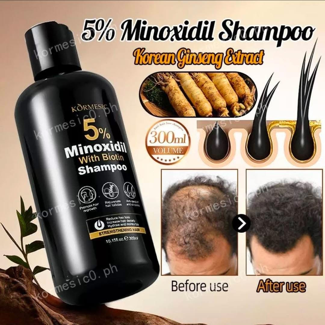 Kormesic Minoxidil 5% Biotin Hair Growth Shampoo And Conditioner 300ml