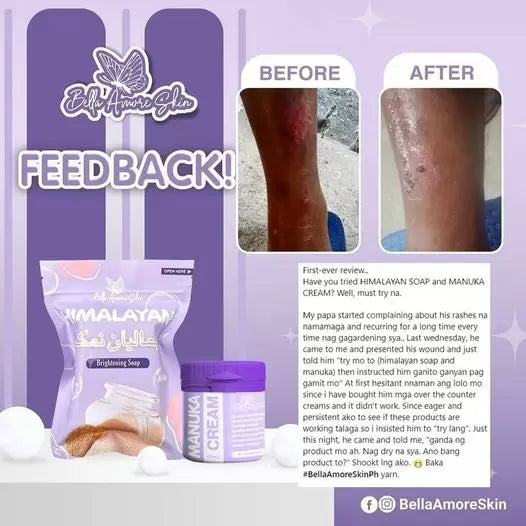 MANUKA CREAM & Himalayan soap by Bella Amore Skin all in 1 Miracle cream 60ml