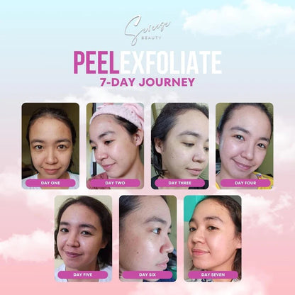 Sereese Beauty Peel Exfoliate Set with Kakadu